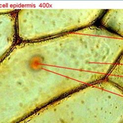 Onion microscope cell cells plant under iodine epidermis animal mount bulb 10x using inner lab compare skin light bubbles air