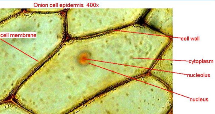 Onion microscope cell cells plant under iodine epidermis animal mount bulb 10x using inner lab compare skin light bubbles air