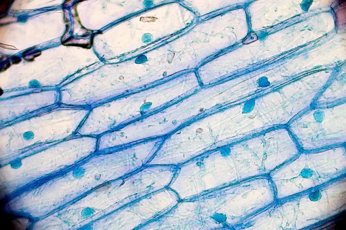 The onion cells i looked at have a nucleus