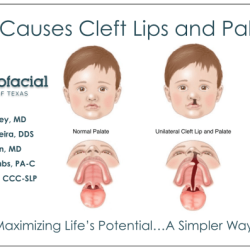 Cpt code for cleft lip repair