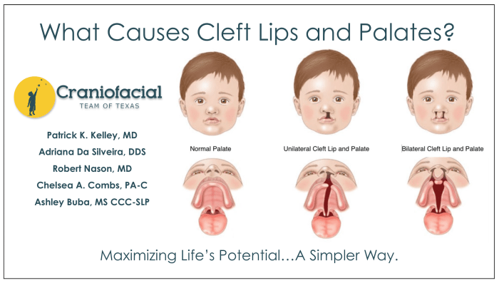 Cpt code for cleft lip repair