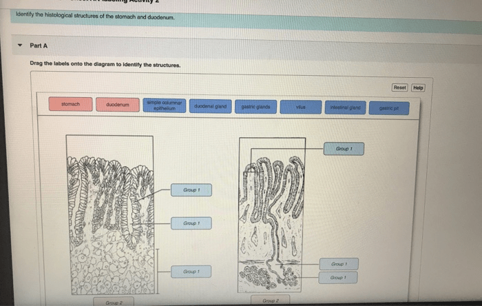 Exercise 38 anatomy of the digestive system