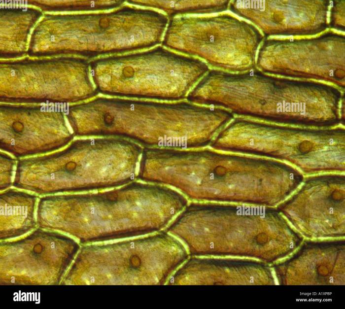 The onion cells i looked at have a nucleus