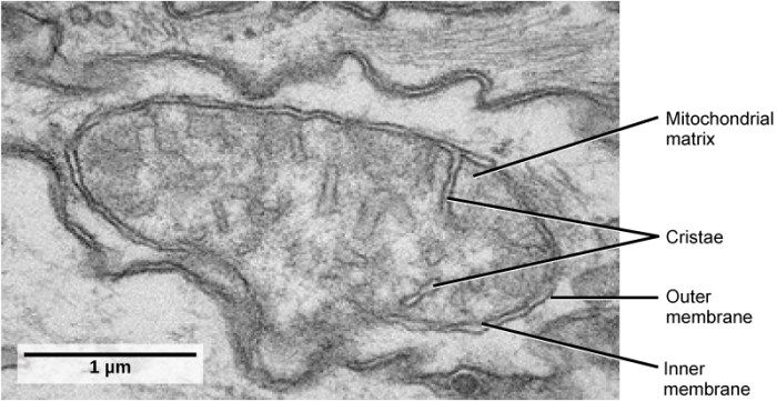 Label the transmission electron micrograph of the mitochondria