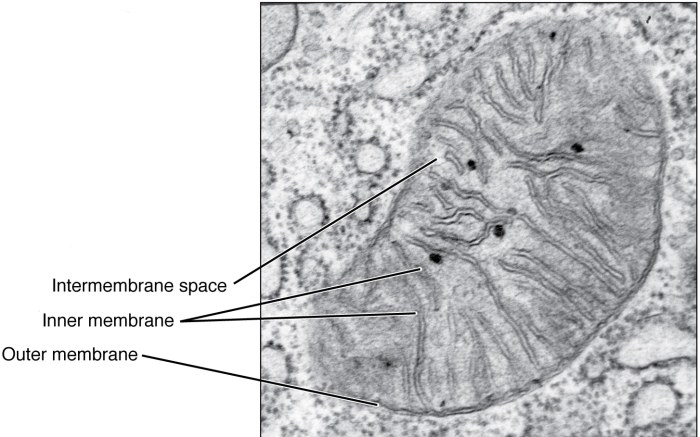 Electron micrograph nucleus micrographs histology