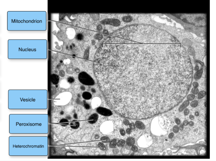 Label the transmission electron micrograph of the mitochondria