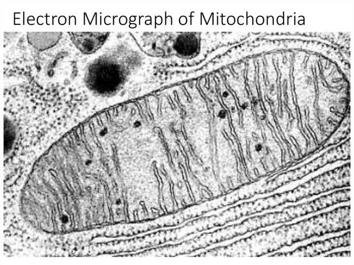 Mitochondria organelles cellular mitochondrion cytoplasm microscope electron respiration figure nucleus energy anatomy cell micrograph diagram cristae membrane em between mitochondrial